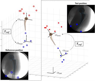Moving fluoroscopy-based analysis of THA kinematics during unrestricted activities of daily living